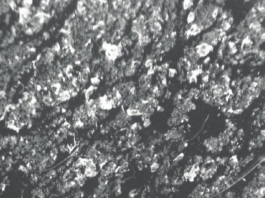 Skin flakes collected on a test disc, day 0