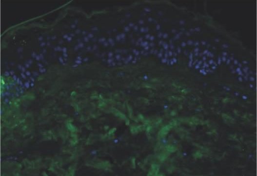Microscope image of skin cells glowing green in a laboratory test