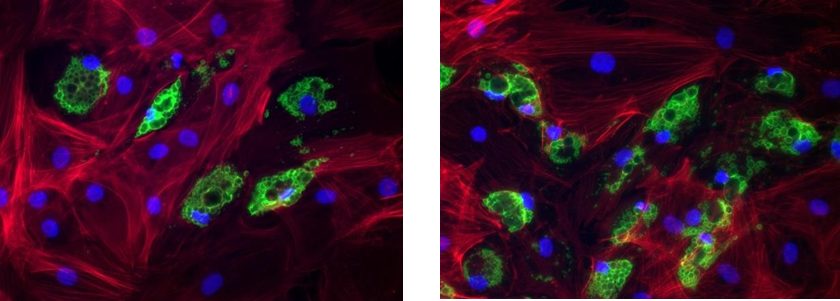 Microscope image of skin cells glowing green
