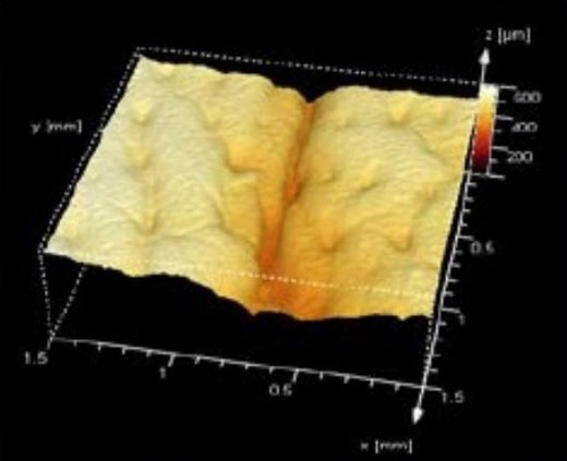 3D scan of a skin replica, placebo, day 0