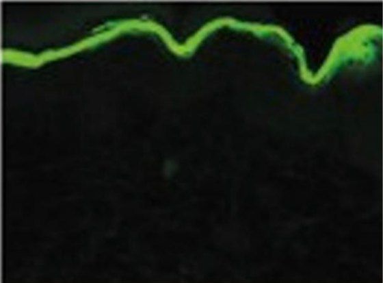 Skin sample after radiation, with carnosine